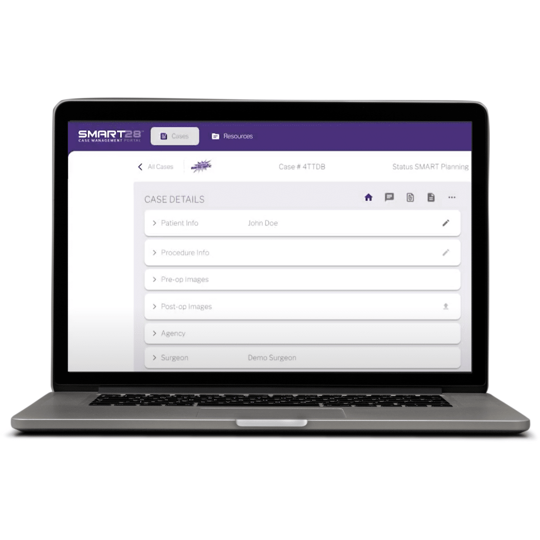 Smart28 Lower Extremity Fracture (LEFX) Virtual Course - Paragon28